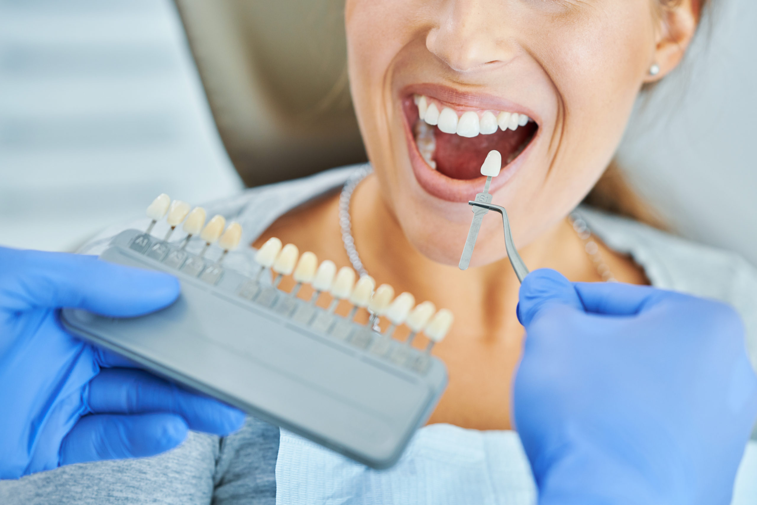 Dental Crown and Bridge Treatment in Trivandrum | Darling Dental Care