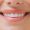 Dental, zoom and woman smile with teeth whitening, results or oral hygiene treatment. Mouth, closeu.