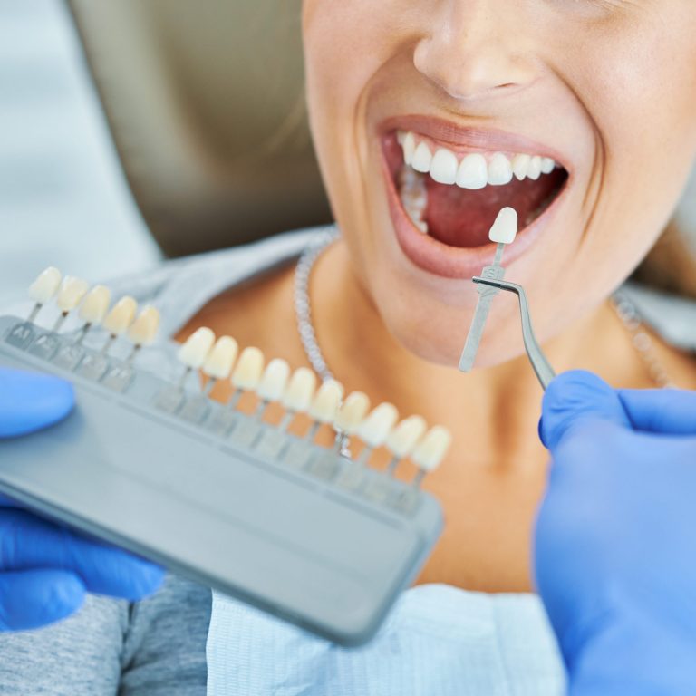 Dental Crown and Bridge Treatment in Trivandrum | Darling Dental Care